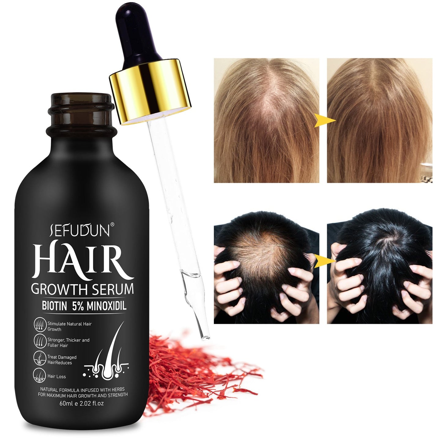 Hair & Beard Growth Oil with 5% Minoxidil – Fast Results
