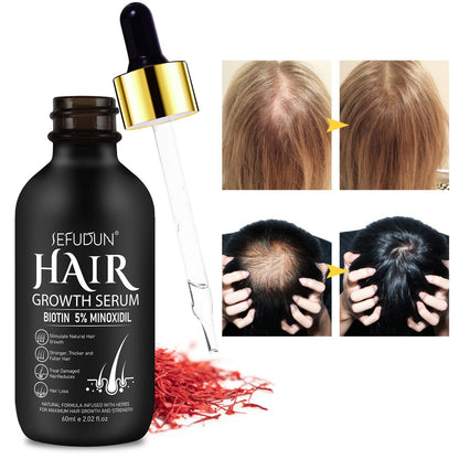 Hair & Beard Growth Oil with 5% Minoxidil – Fast Results